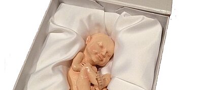 Már gyereket is lehet nyomtatni a 3D-s printereknek köszönhetően