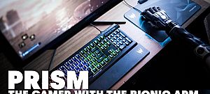 A valóságban viseli a Deus Ex videójáték főszereplőjének karját ez a fiatalember