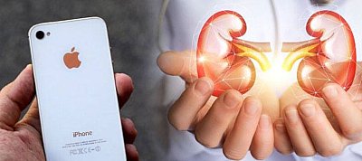 Haldoklik a fiatal, aki eladta veséjét, hogy iPhone-t vehessen